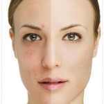 Manchas Na Pele: O Que Aprendi Com Minha Dermato