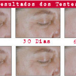O Laser Em Creme Chegou!