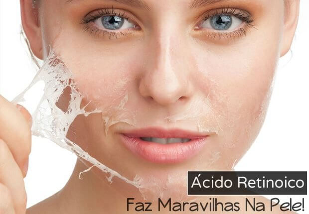 RETINÓIDES: ATIVOS ANTIENVELHECIMENTO (VITACID, VITANOL A, RETINOL