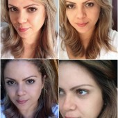 O Que Realmente Funciona Pra Evitar as Rugas?