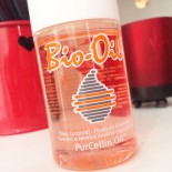 Bio Oil nas Estrias Funciona Mesmo?