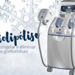 Criolipólise: Eu Fiz!