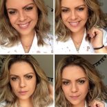 Meu Primeiro Botox!