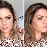 Como Fazer o Efeito do Botox Durar Mais?