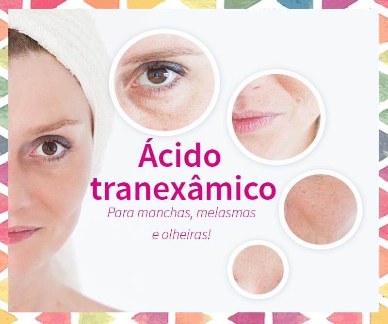ácido tranexâmico manchas melasma olheiras