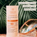 Melasma no Rosto: Como cuidar?