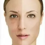 Manchas Na Pele: O Que Aprendi Com Minha Dermato