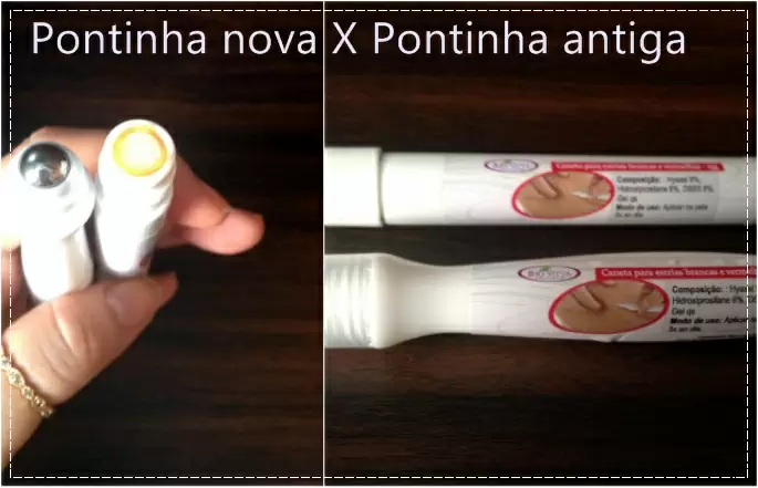  A Caneta Que Acaba Com As Estrias!