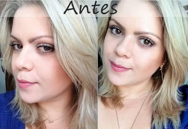 Formula Para Fazer O Cabelo Crescer Antes E Depois Juro Valendo