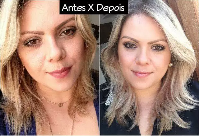remédio para o cabelo crescer antes e depois