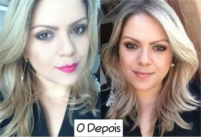 remédio para o cabelo crescer antes e depois