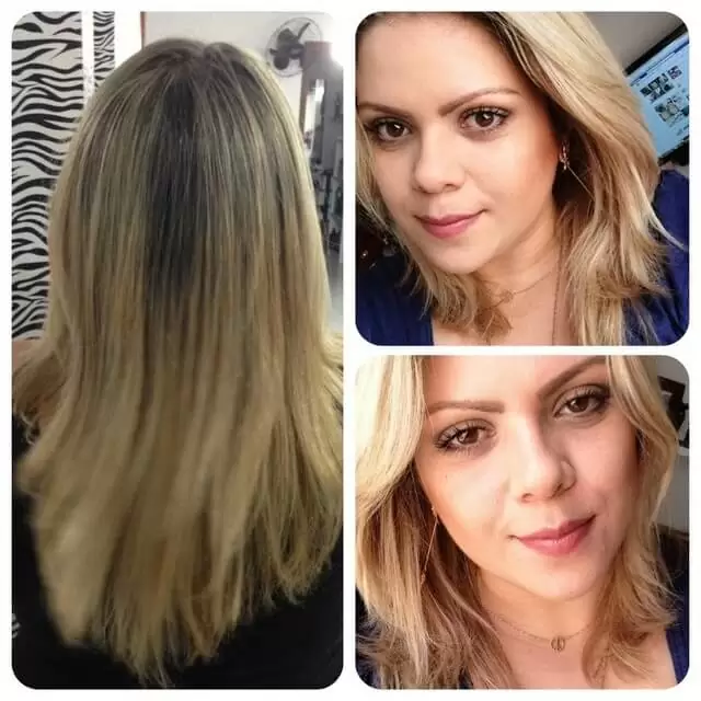 remédio para o cabelo crescer antes e depois