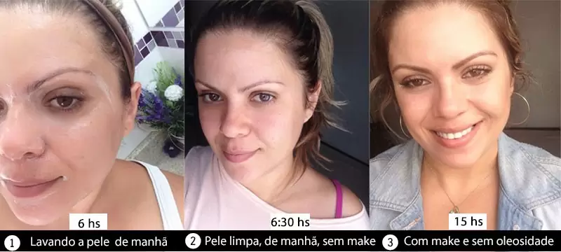 antes e depois