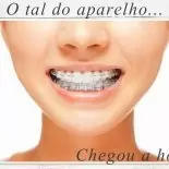 Aparelho Depois dos 30: Lá Vou Eu!