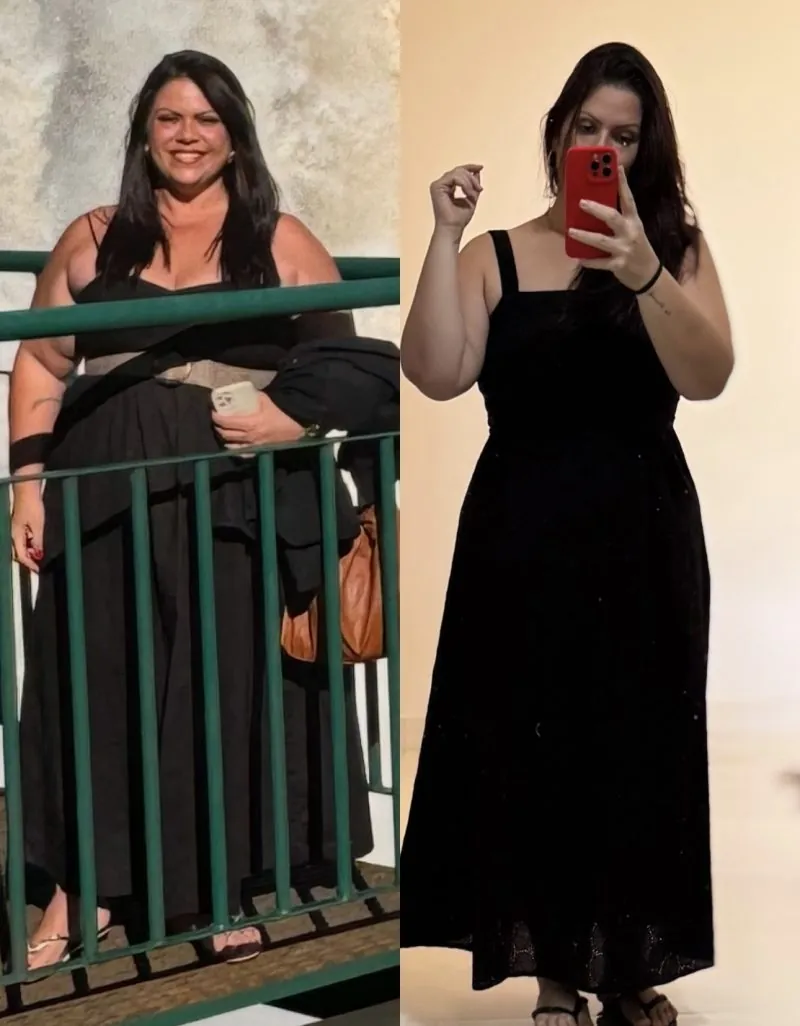 antes e depois de emagrecer rápidp